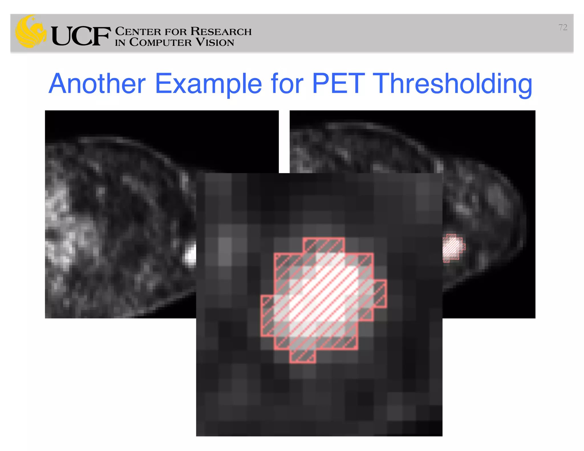 Another Example for PET Thresholding
72
 