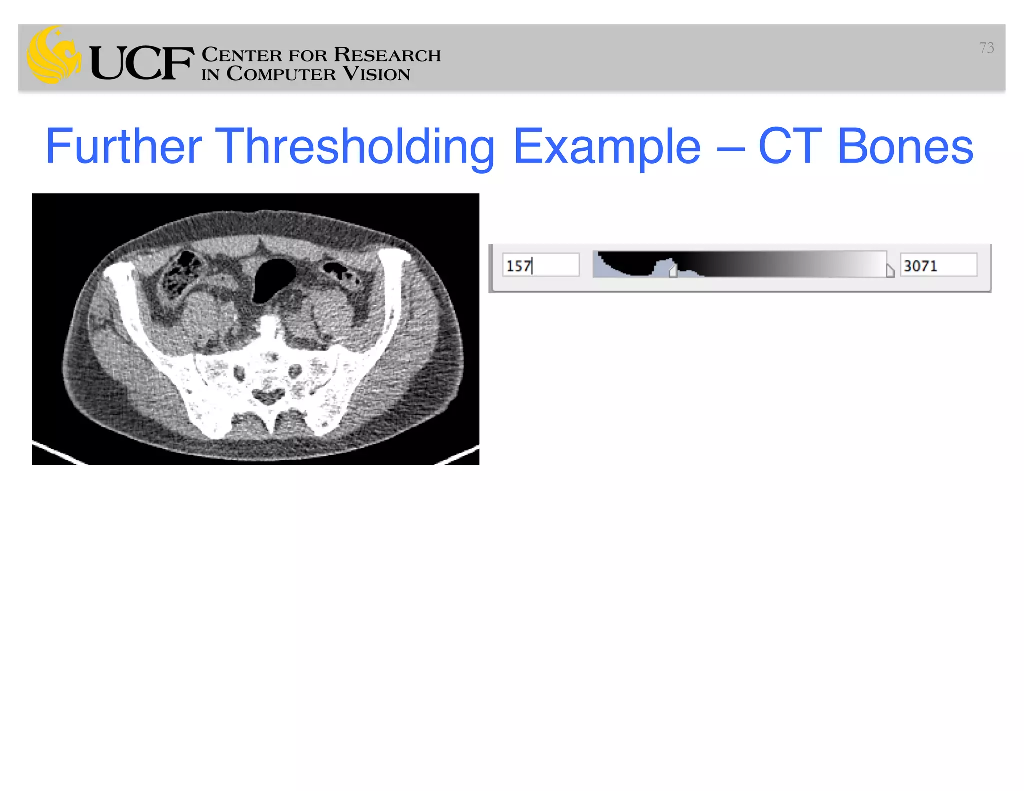 Further Thresholding Example – CT Bones
73
 