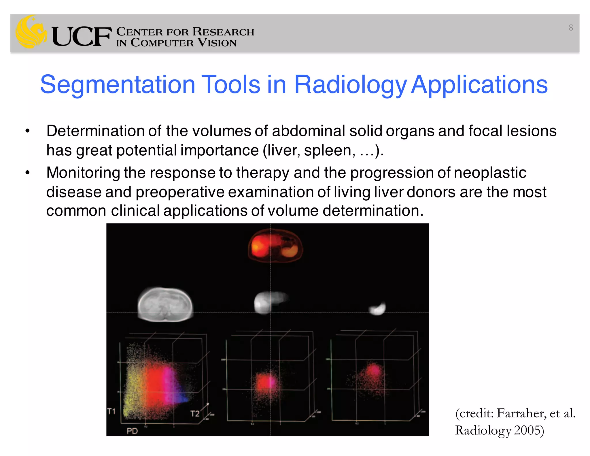 • Determination of the volumes of abdominal solid organs and focal lesions
has great potential importance (liver, spleen, …).
• Monitoring the response to therapy and the progression of neoplastic
disease and preoperative examination of living liver donors are the most
common clinical applications of volume determination.
8
Segmentation Tools in RadiologyApplications
(credit: Farraher, et al.
Radiology 2005)
 
