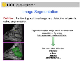 Lec7: Medical Image Segmentation (I) (Radiology Applications of ...