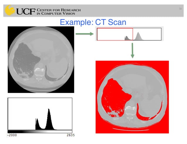 Lec7: Medical Image Segmentation (I) (Radiology Applications of ...