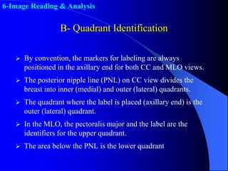Quadrant Identifier Lec_7_How to read Mammography_7-5-25 (1).pdf