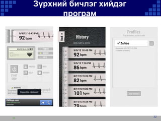 Зүрхний бичлэг хийдэг
програм

32

32

 