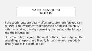 Mechanical Principles Involved in Tooth Extraction 2 | PPTX