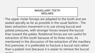 Mechanical Principles Involved in Tooth Extraction 2