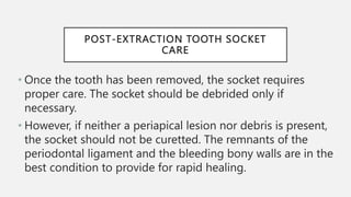 Mechanical Principles Involved in Tooth Extraction 2