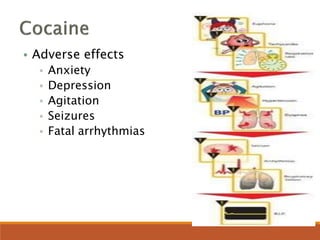 • Adverse effects
• Anxiety
• Depression
• Agitation
• Seizures
• Fatal arrhythmias
 