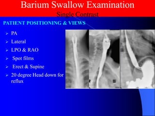 Lec_9_Barium Swallow_5-5-25.pdf........... | PDF
