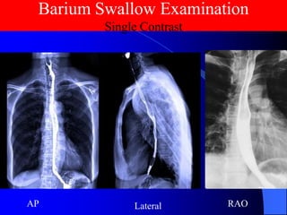 Lec_9_Barium Swallow_5-5-25.pdf........... | PDF