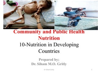 Community and Public Health
Nutrition
10-Nutrition in Developing
Countries
Prepared by;
Dr. Siham M.O. Gritly
1Dr Siham Gritly
 