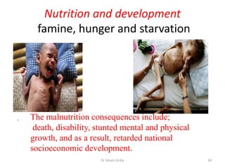 Nutrition and development
famine, hunger and starvation
.
34Dr Siham Gritly
The malnutrition consequences include;
death, disability, stunted mental and physical
growth, and as a result, retarded national
socioeconomic development.
 