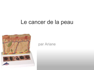 Le cancer de la peau


      par Ariane
 
