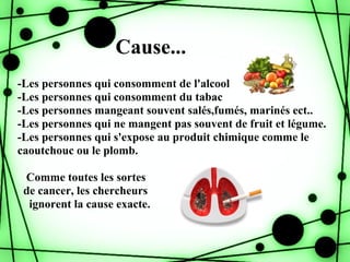 Cause...
-Les personnes qui consomment de l'alcool
-Les personnes qui consomment du tabac
-Les personnes mangeant souvent salés,fumés, marinés ect..
-Les personnes qui ne mangent pas souvent de fruit et légume.
-Les personnes qui s'expose au produit chimique comme le
caoutchouc ou le plomb.

 Comme toutes les sortes
 de cancer, les chercheurs
  ignorent la cause exacte.
 