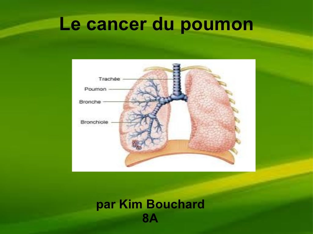 Le cancer des_poumons
