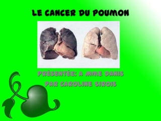 Le cancer du poumon




 Présentée: a Mme Danis
   par Caroline Sirois
 
