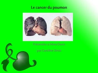 Le cancer dupoumon
Présentée:a Mme Danis
par Caroline Sirois
 