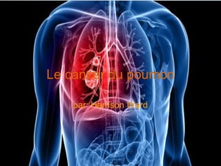 Le cancer du poumon
par: Harrison Ward
 