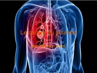 Le cancer du poumon par: Harrison Ward 