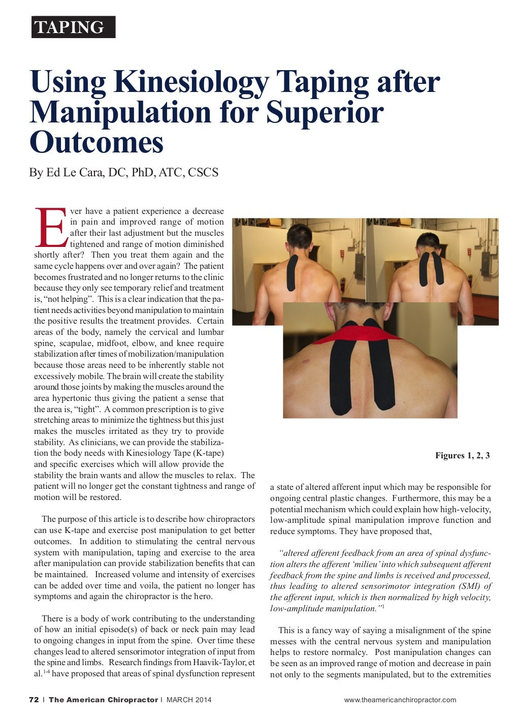 Using Kinesiology Taping after Manipulation for Superior