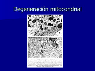 Degeneración mitocondrial 