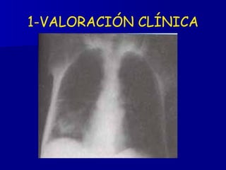 1-VALORACIÓN CLÍNICA 