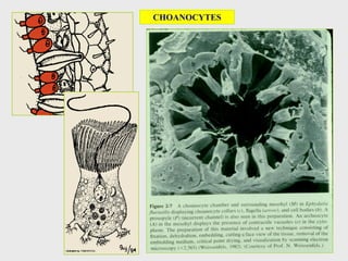 CHOANOCYTES
 