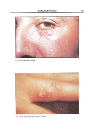 Lecciones de Dermatología