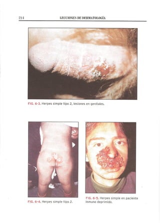 Lecciones de Dermatología