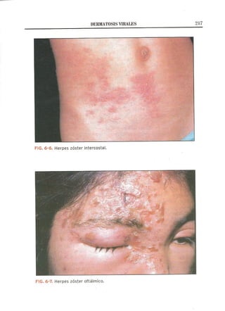 Lecciones de Dermatología