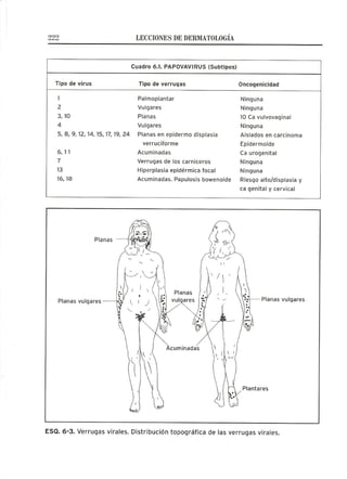 Lecciones de Dermatología