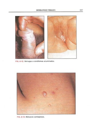 Lecciones de Dermatología