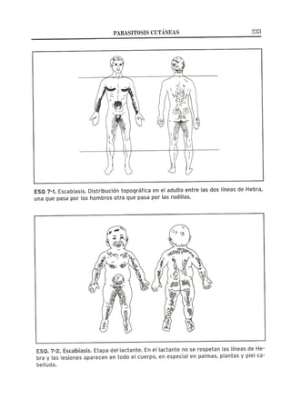 Lecciones de Dermatología