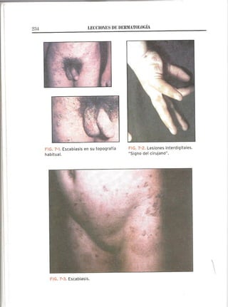 Lecciones de Dermatología