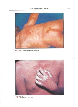 Lecciones de Dermatología