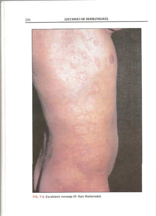 Lecciones de Dermatología