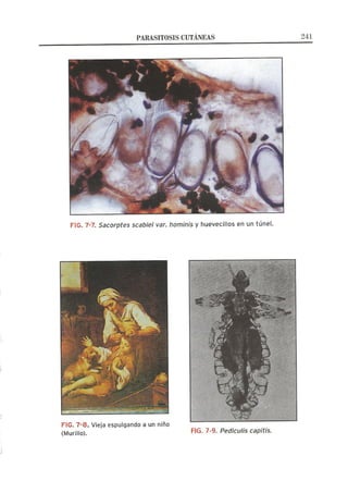 Lecciones de Dermatología