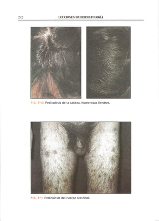 Lecciones de Dermatología