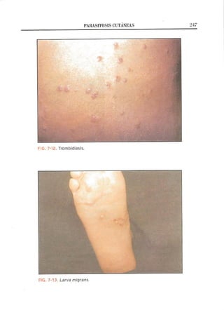 Lecciones de Dermatología