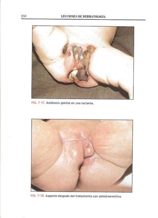 Lecciones de Dermatología