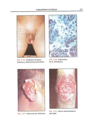 Lecciones de Dermatología