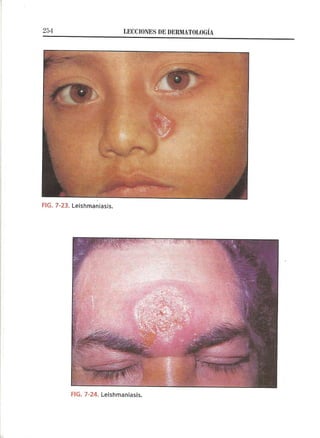 Lecciones de Dermatología