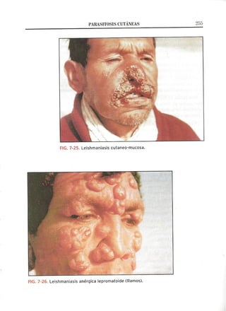 Lecciones de Dermatología