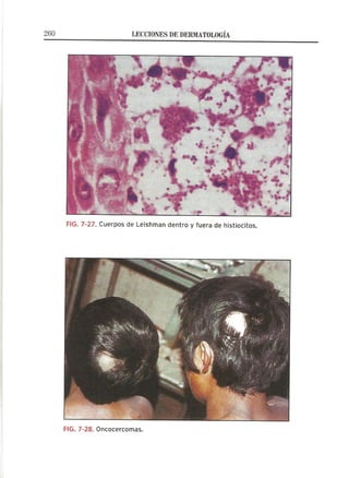 Lecciones de Dermatología