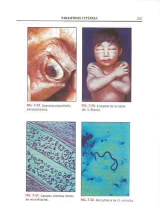 Lecciones de Dermatología