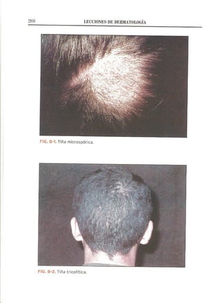 Lecciones de Dermatología