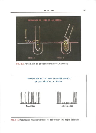 Lecciones de Dermatología