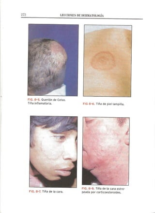 Lecciones de Dermatología