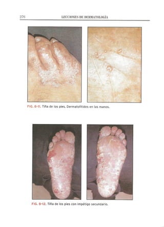 Lecciones de Dermatología