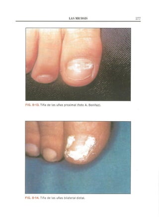 Lecciones de Dermatología