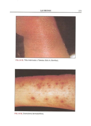 Lecciones de Dermatología